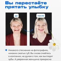 Все зубы за 1 день Рассрочка – Синицына Лолита, Москва