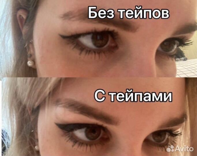 Тейпы от нависших век и подбородка