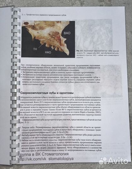 Хирургическое и ортодонтическое лечение