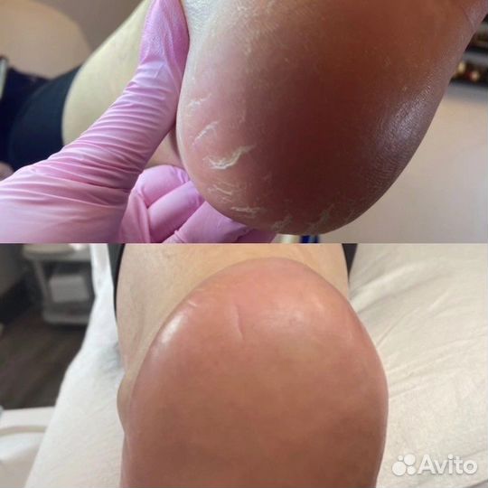 Smart педикюр от лицензированного мастера