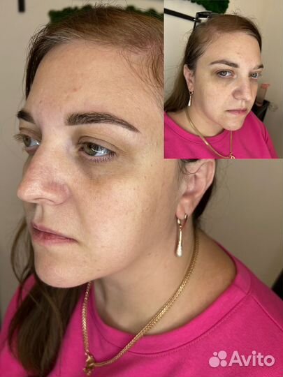 Модели на бьюти-процедуры