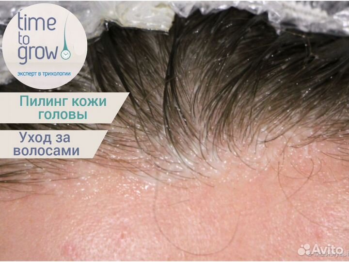 Пилинг для кожи головы Time to grow