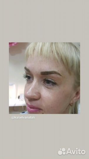 Перманентный макияж (брови,губы,веки.) Удаление пм