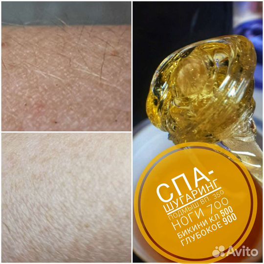 Шугаринг депиляция