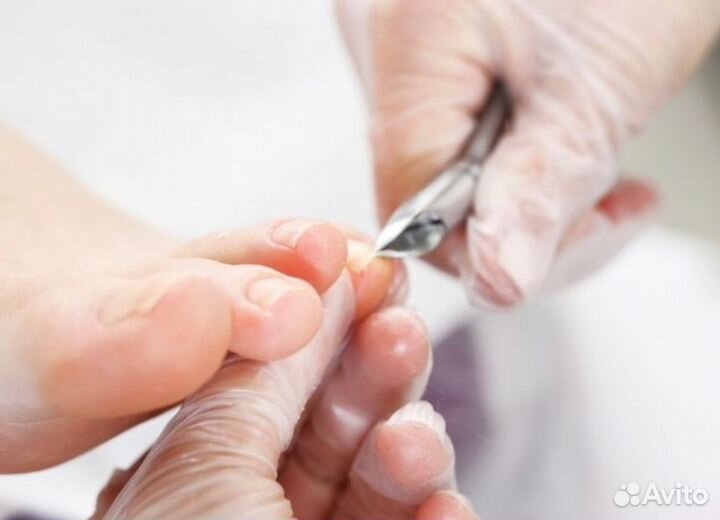 Педикюр