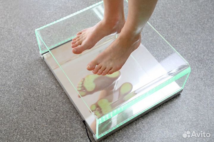 Изготовление индивидуальных ортопедических стелек