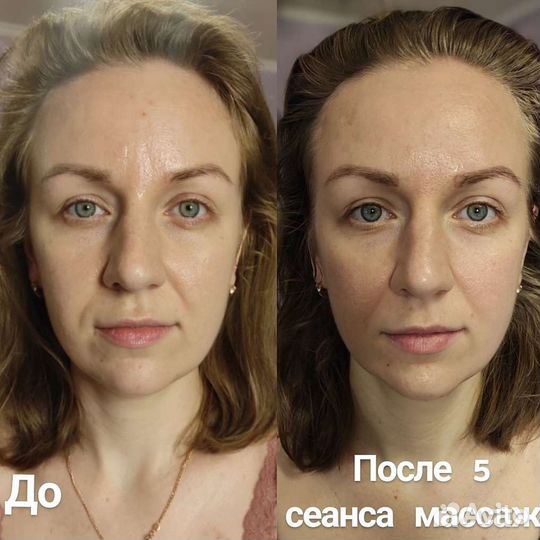 Косметолог. Чистка лица.Массажи