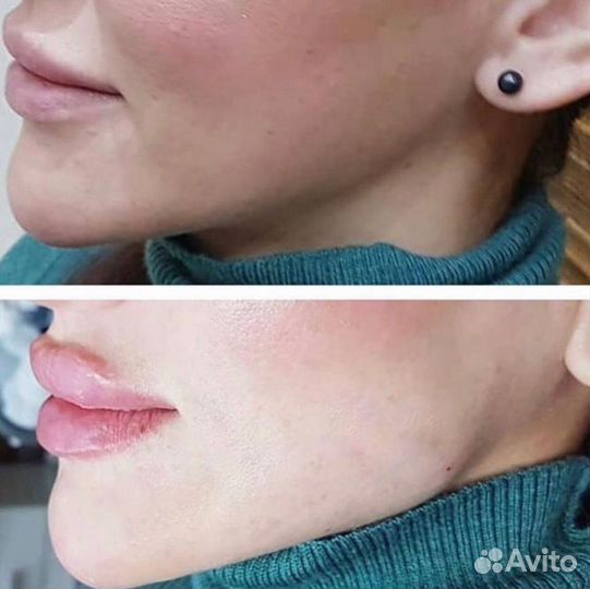 Обучение косметологов