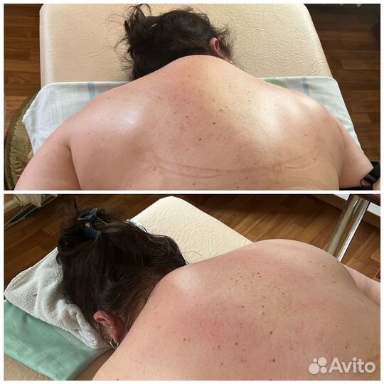 Массаж Луганск