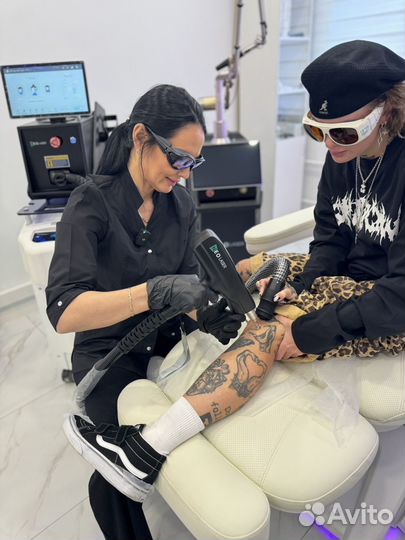 Лазерное удаление тату, ПМ, карбоновый пилинг