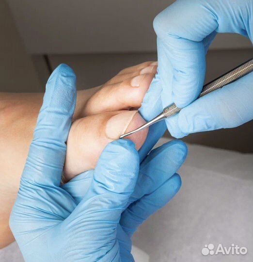 Услуги подолога Лобня