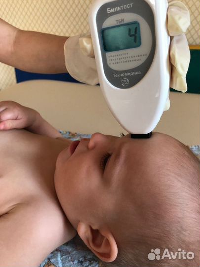 Лампа от желтушки и билитест