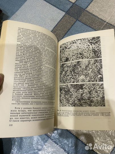 Самсонов В.А.: Опухоли мочевого пузыря 1978г
