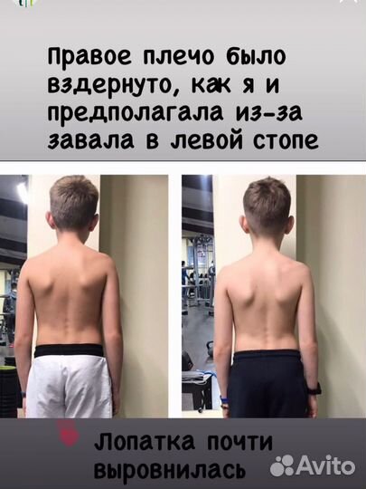 Коррекция вальгуса и осанки детям и взрослым