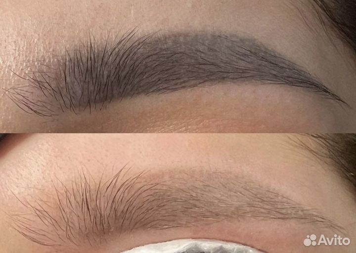 Удаление татуажа и татуировок