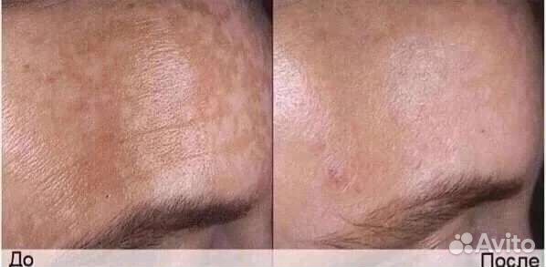 Сыворотка для идеального тона лица