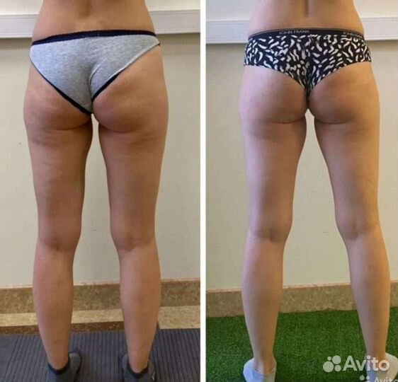 Снижения веса без спорт зала и с удовольствием