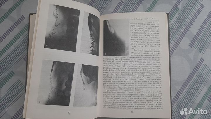 Одонтогенные воспалительные заболевания