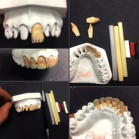 Зубной техник обучение