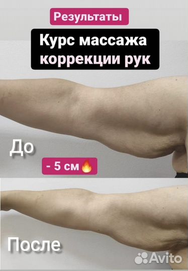 Массаж коррекции фигуры акция