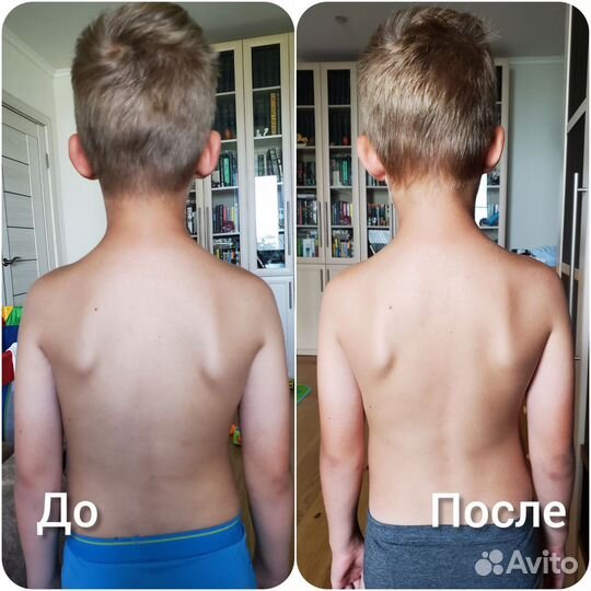 Прикладная кинезиология. Коррекция родовой травмы