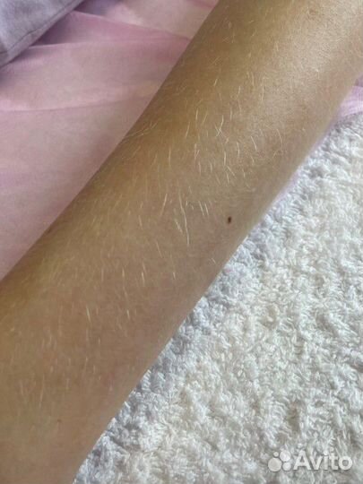 Шугаринг для женщин и мужчин. Электроэпиляция