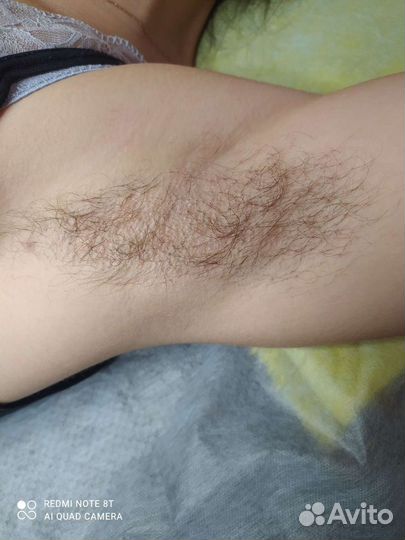 Депиляция воском: руки выше локтя