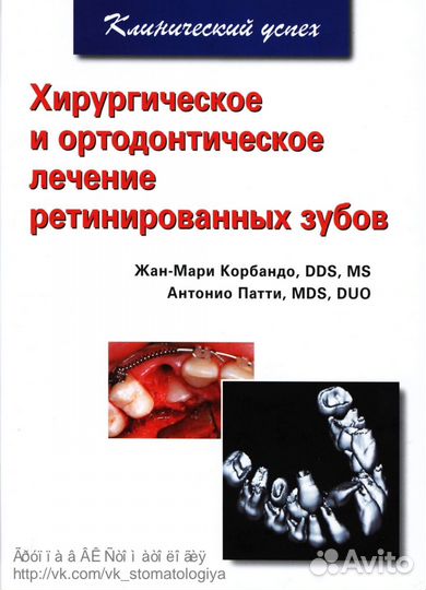 Хирургическое и ортодонтическое лечение ретинирова