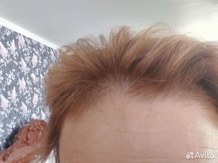 Биологическое средство от выпадения волос Италия