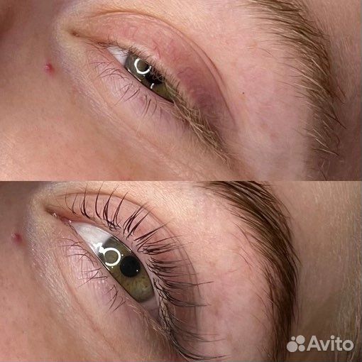 Брови и ресницы