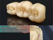 Коронки из диоксида циркония. Сотрудничетсво