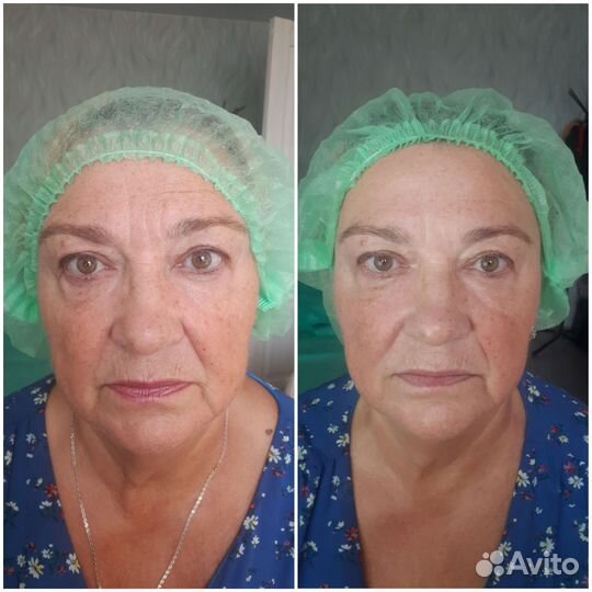 Массаж лица