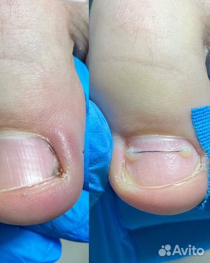 Услуги подолога