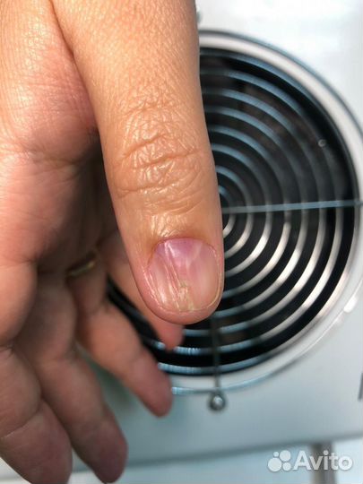 Подолог с выездом на дом