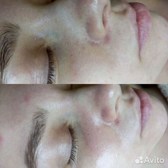 Массаж,косметология