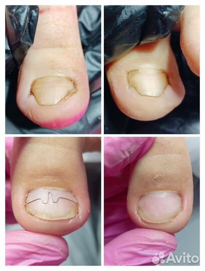 Подолог, Маникюр и педикюр