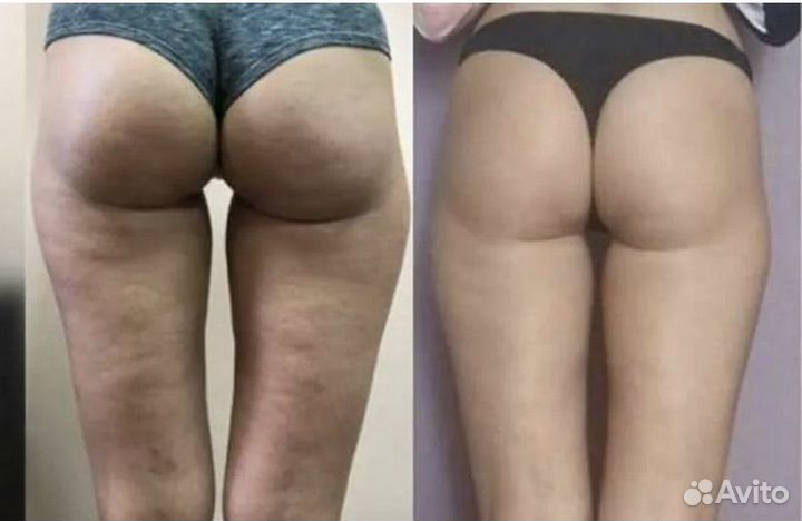 Ручной массаж