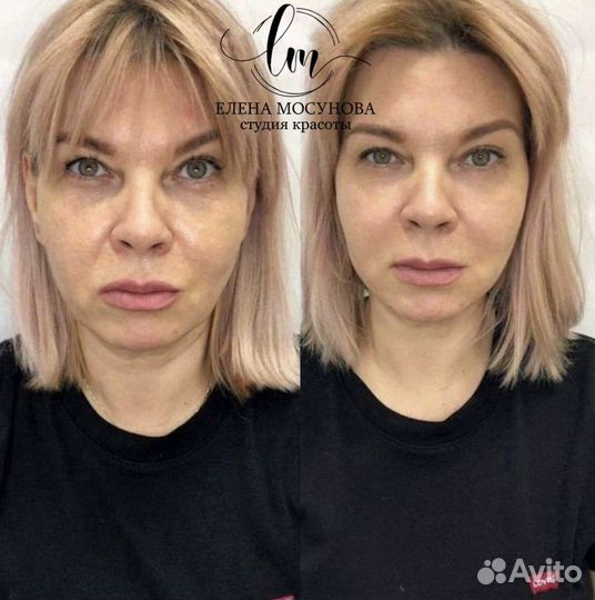 Массаж лица