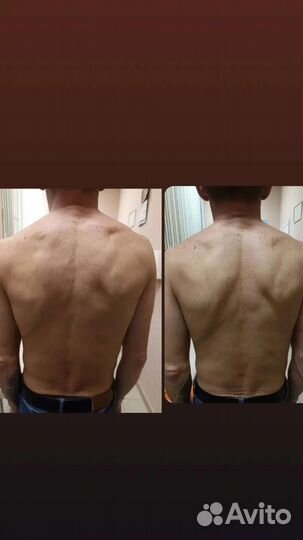 Массаж костоправ Оздоровительный массаж