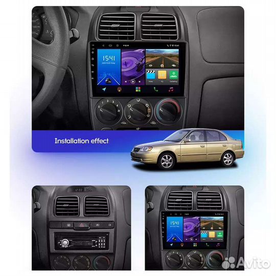 Магнитола 9