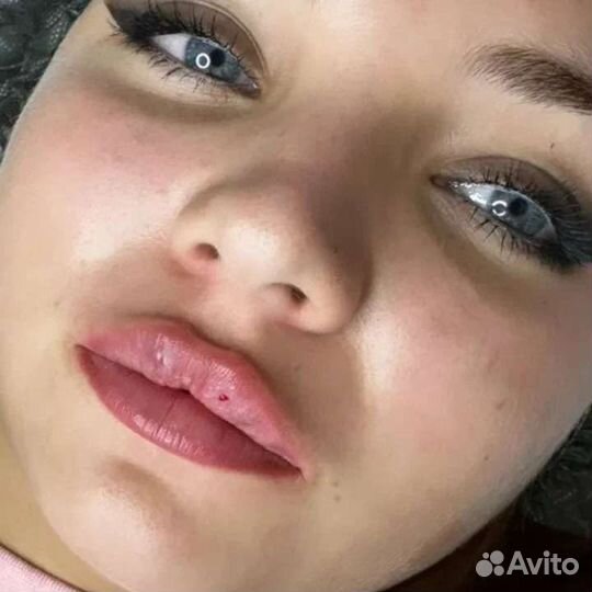 Увеличение губ