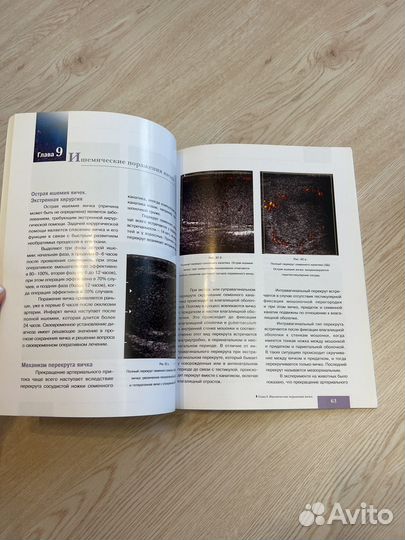 Атлас ультразвуковой диагностики органов мошонки