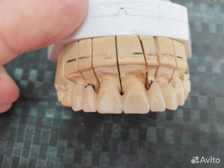 Услуги зубного техника