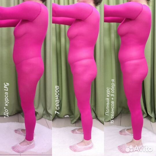 Массаж вакуумно-роликовый LPG / LPG массаж