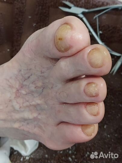 Подолог,выезд круглосуточно 24/7