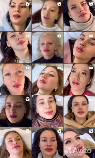 Требуются модели на увеличение губ