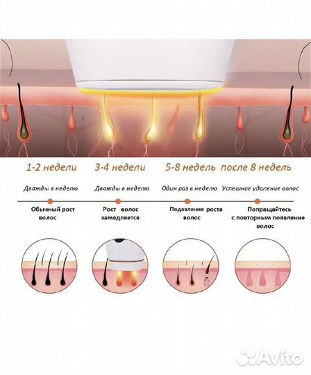 Фотоэпилятор