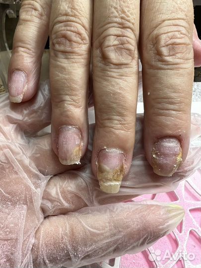 Бесплатная консультация подолога