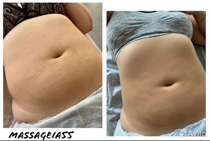 Массаж