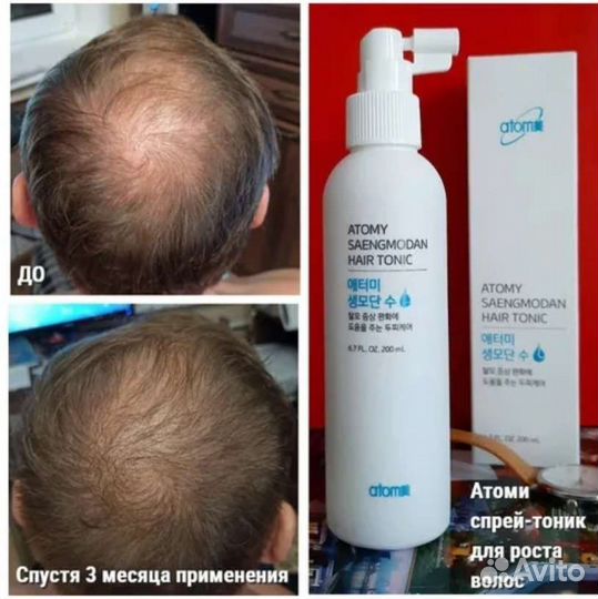 Стимулятор роста волос, против выпадения атоми